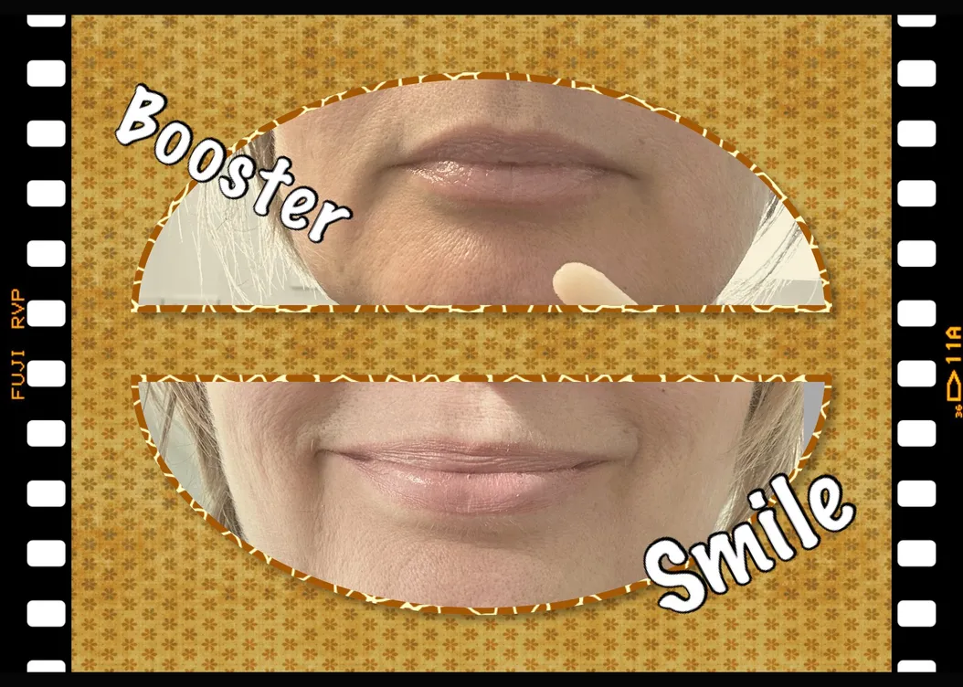 LIppen mit einem Booster, darunter lächelnde Lippen